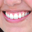 Small image